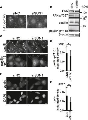 Inner Nuclear Membrane Protein, SUN1, is Required for Cytoskeletal Force Generation and Focal Adhesion Maturation